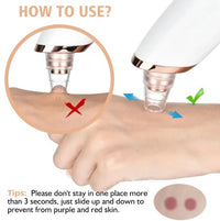 Blackhead Remover