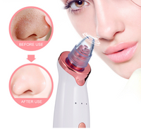 Electric Blackhead Remover